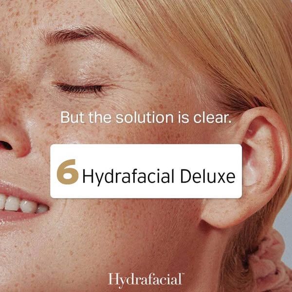 Hydrafacial® Deluxe - Image 8