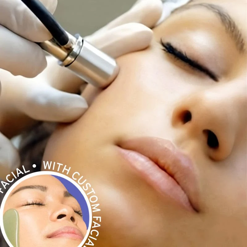 Microdermabrasion - Image 8