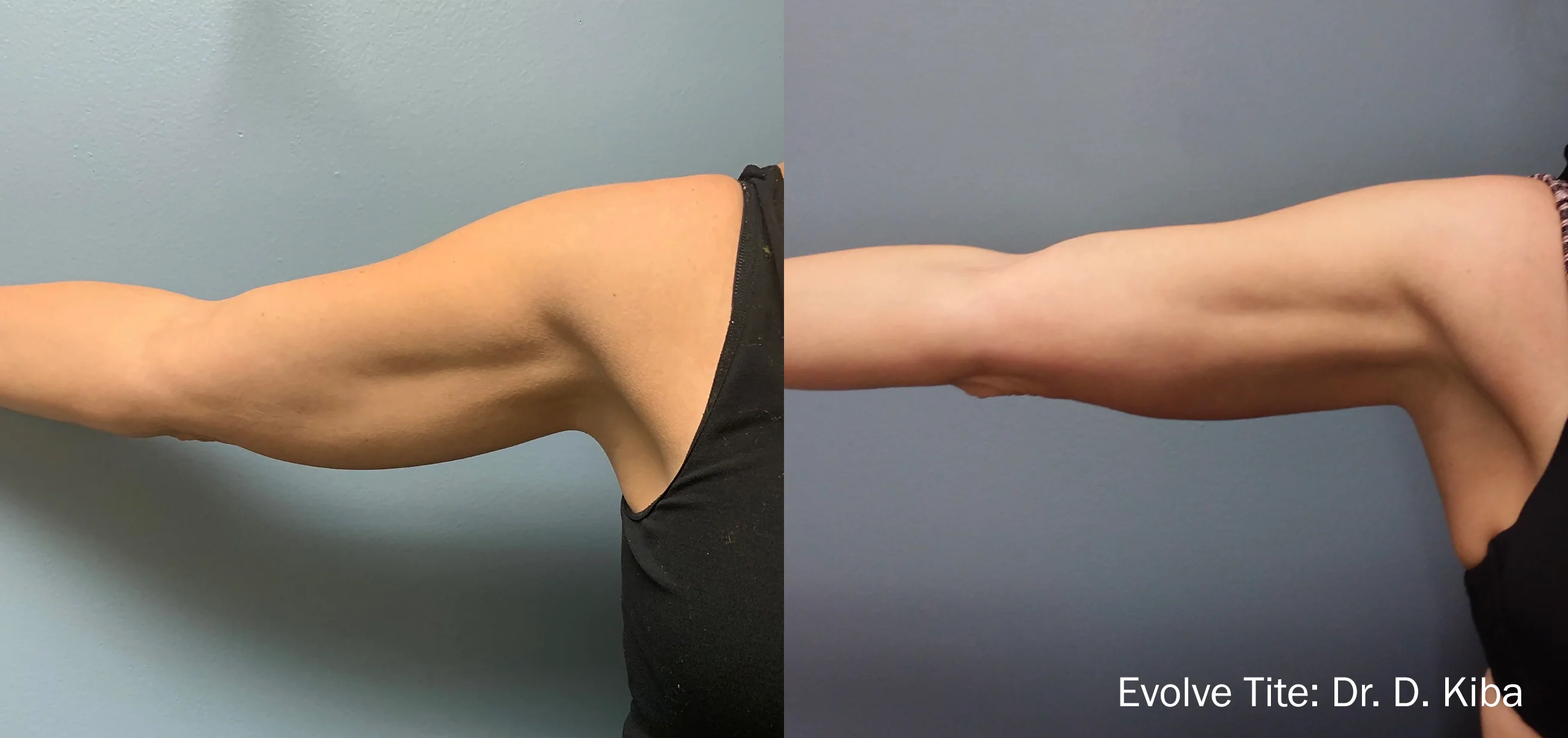 EVOLVEX - Transform, Tite & Tone - Image 3